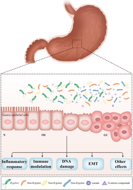 Zdroj obrázku: Yang et al., 2021. Role of the Gastric Microbiome in Gastric Cancer: From Carcinogenesis to Treatment